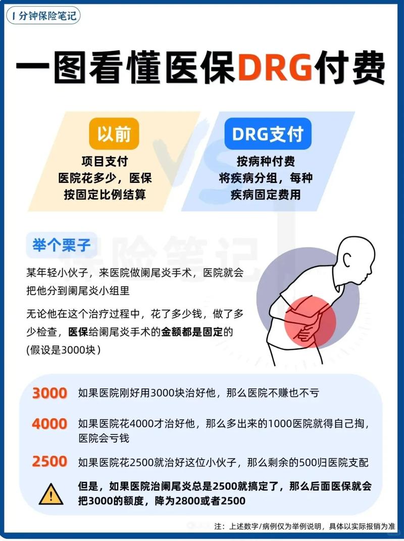 医疗DRG改革(医保支付方式)(医保drg试点是什么)