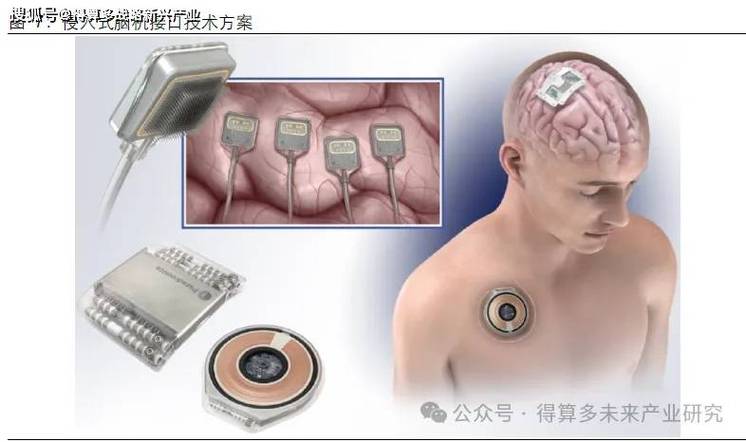 脑机接口(医疗康复应用)(脑机接口的原理与应用)