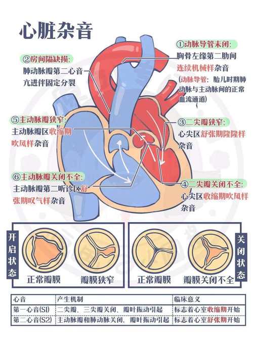 心血管事件链共识（心血管事件链中间环节包括哪些）